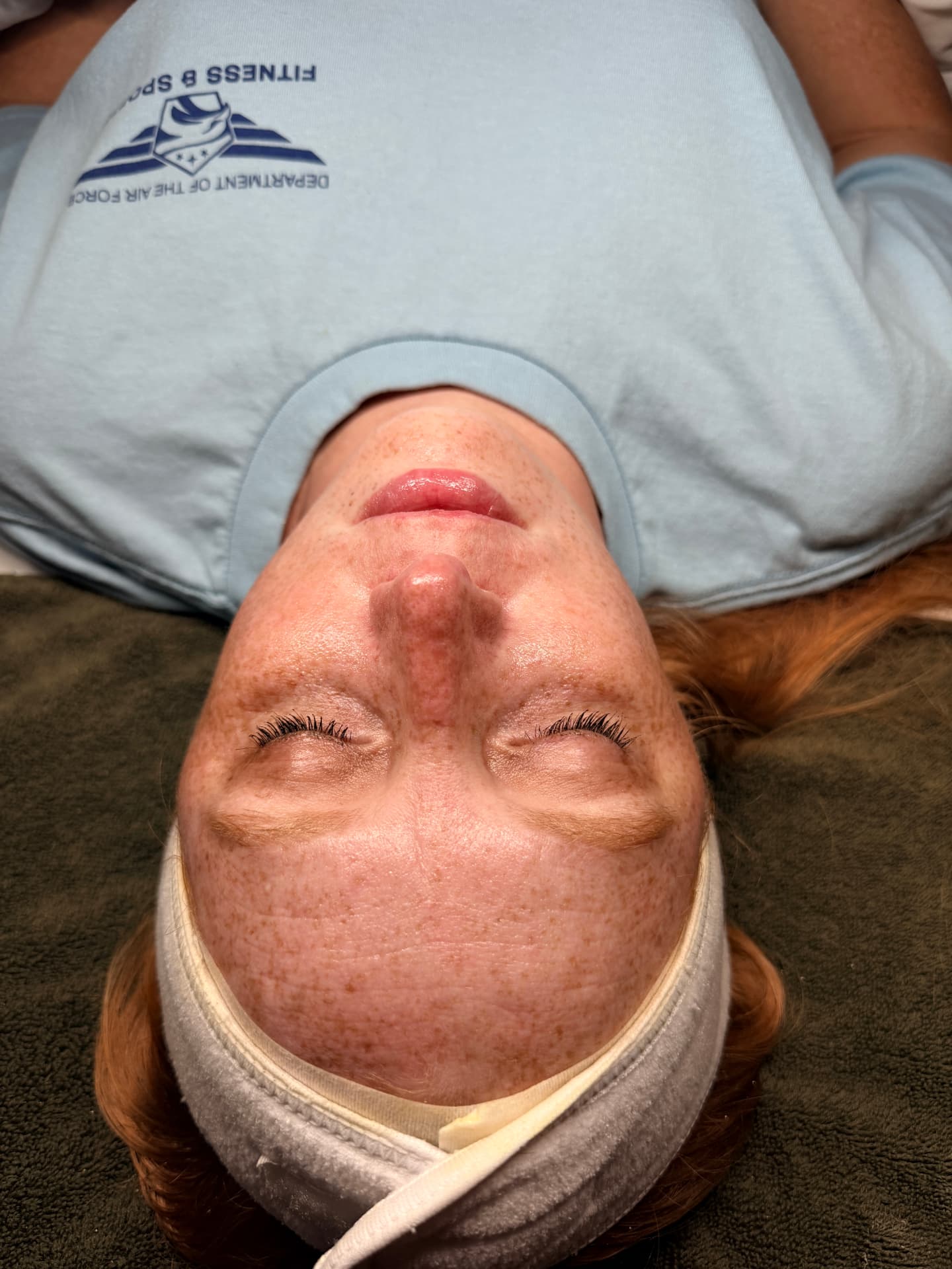 Client with freckled skin after a hydrating facial