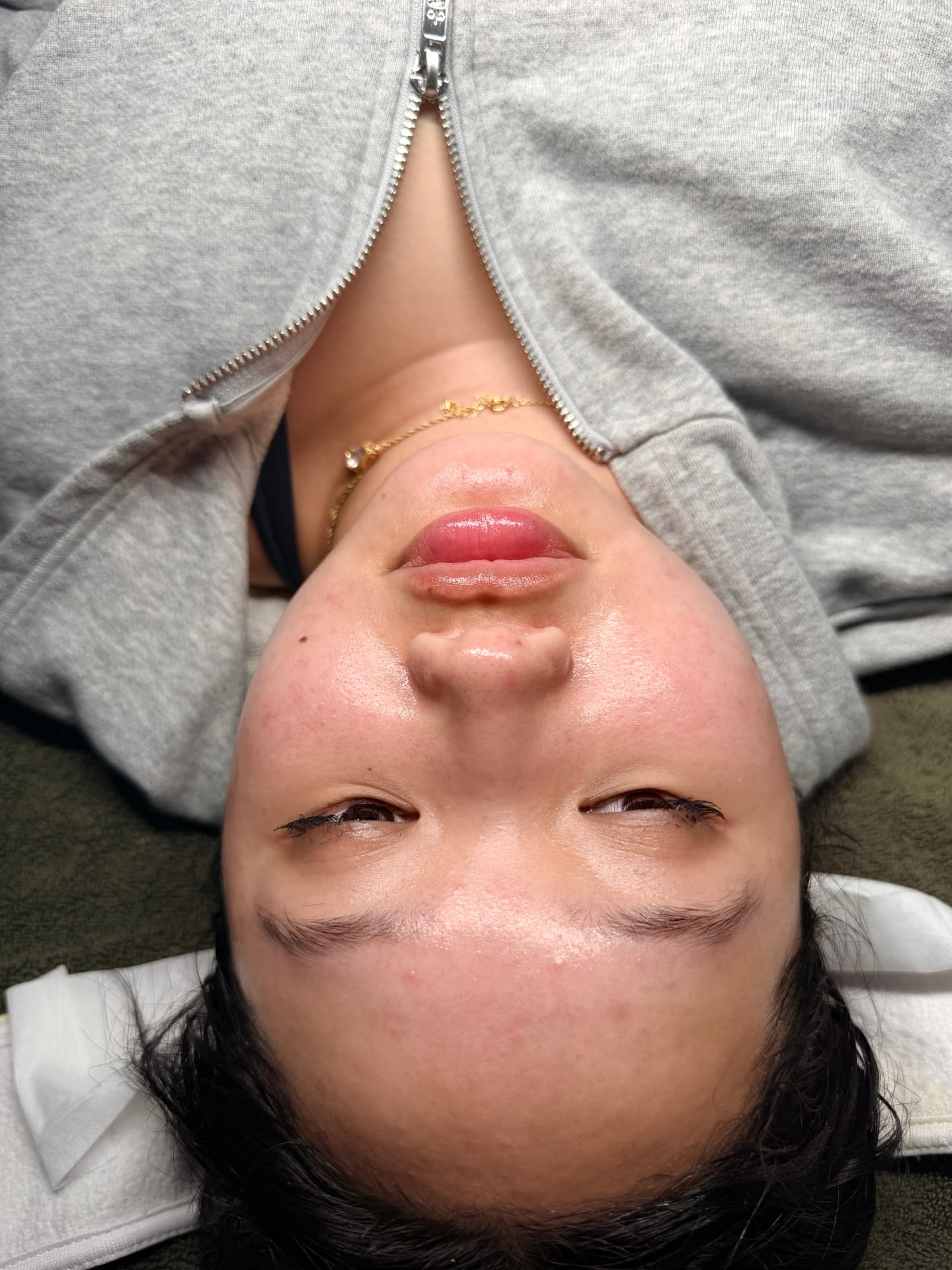 Client with calm, hydrated skin after a barrier-restoring facial